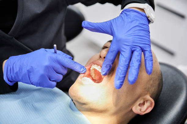Best Knocked-Out Tooth (Avulsed Tooth) Treatment in Pelham Manor, NY